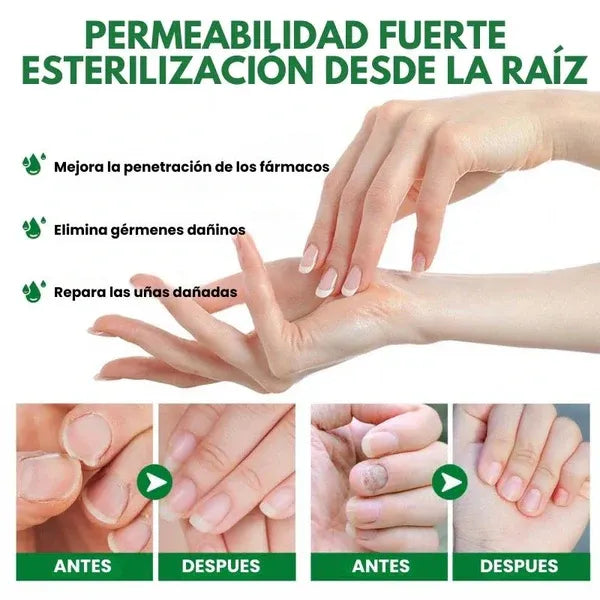 🌿 Toenail Plus™ – Elimina los hongos desde la raíz